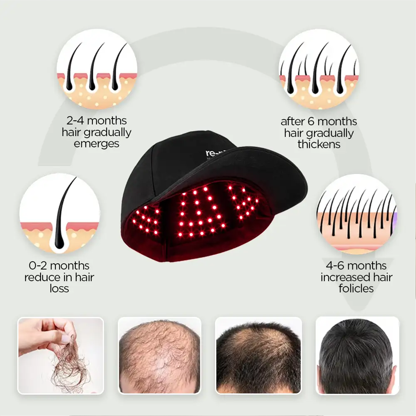 re-nu Smart Beauty LED Red Light Therapy Cap